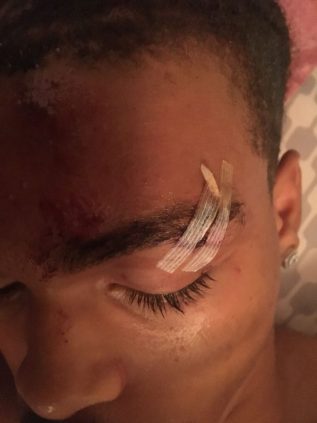 20-Year-Old-Dre-Harris-Brutally-Attacked-By-White-Supremacists